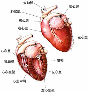 拡張型心筋症