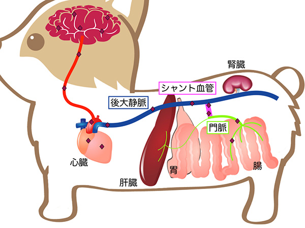 門脈体循環シャント